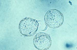 An 8-and-a-half-day-old bovine embryo