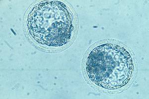 A 7-and-a-half-day-old bovine embryo