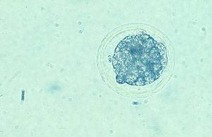 7 day old bovine embryo